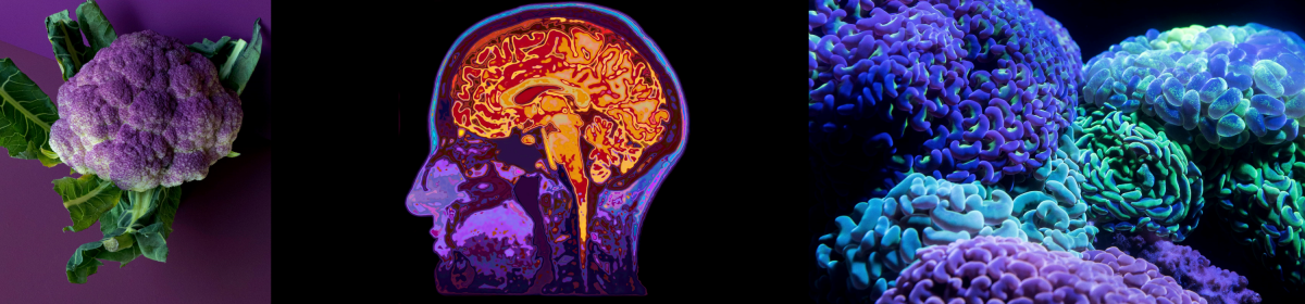 Purple cauliflower, mri image of brain, and coral